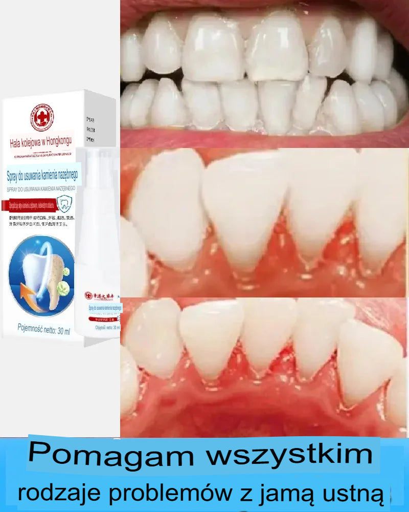 Spray do świeżego oddechu