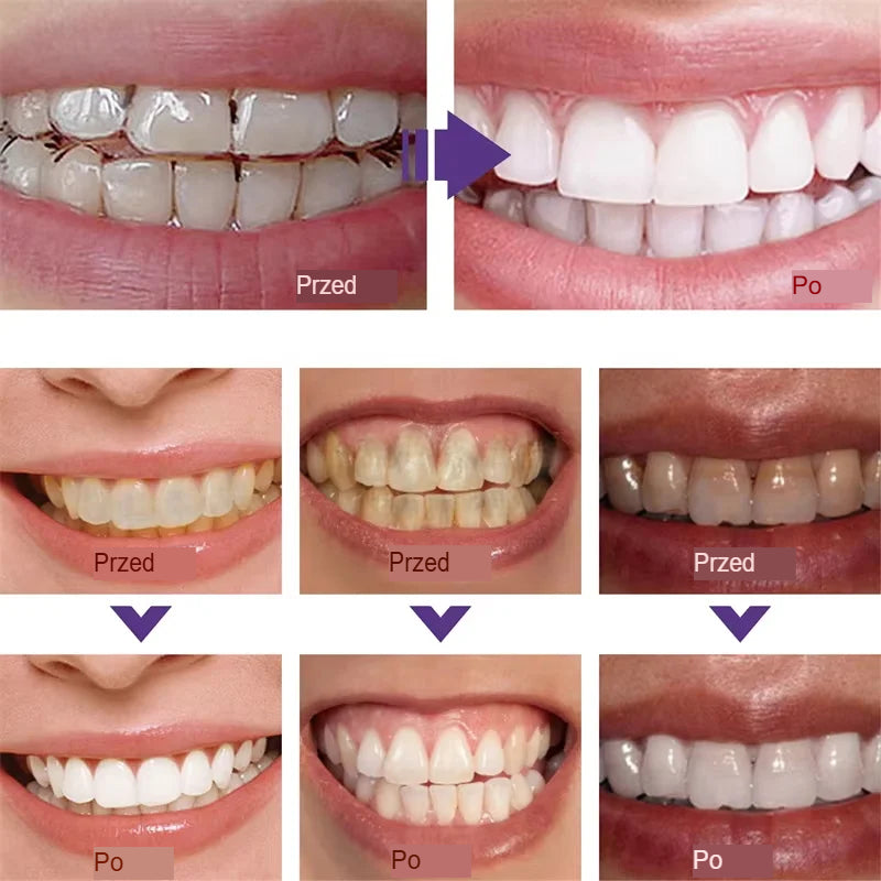 Błyszczący Uśmiech Codziennie