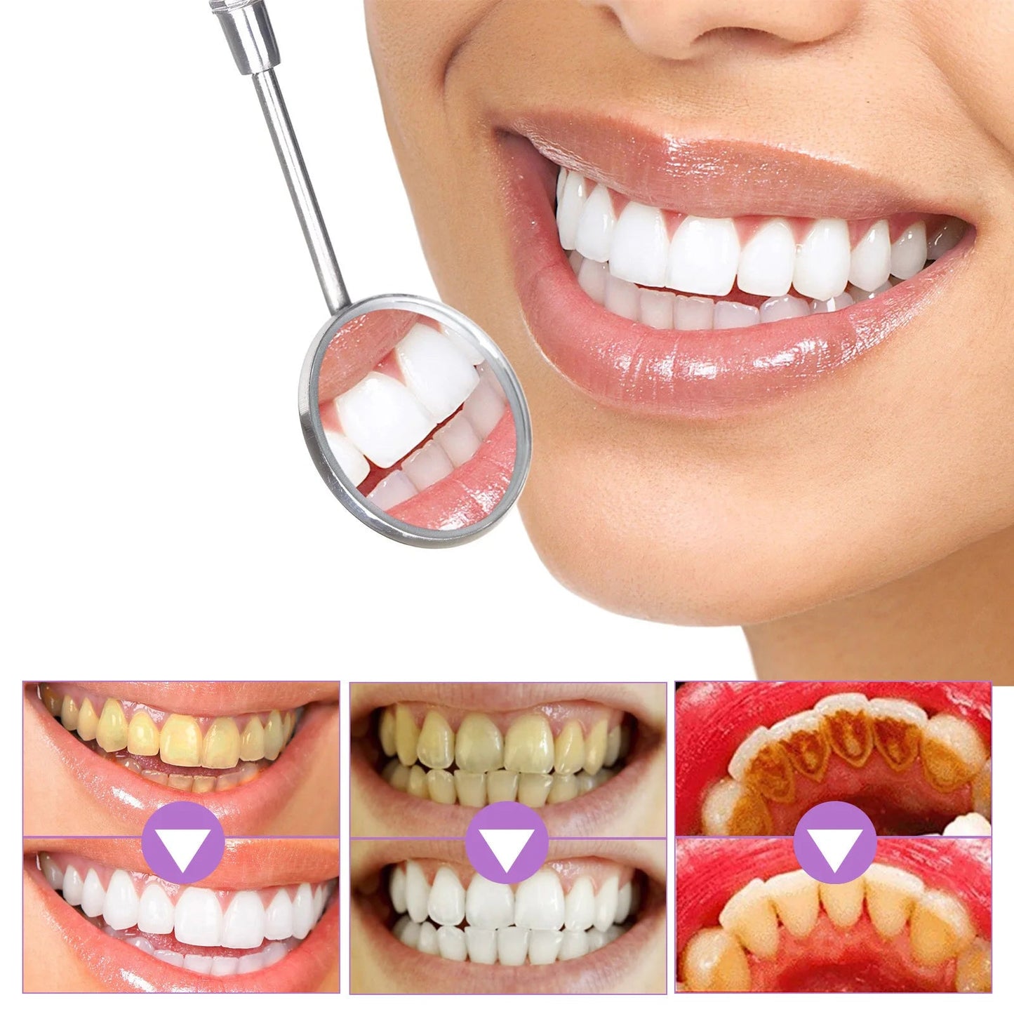 Fioletowe Paski Wybielające Zęby