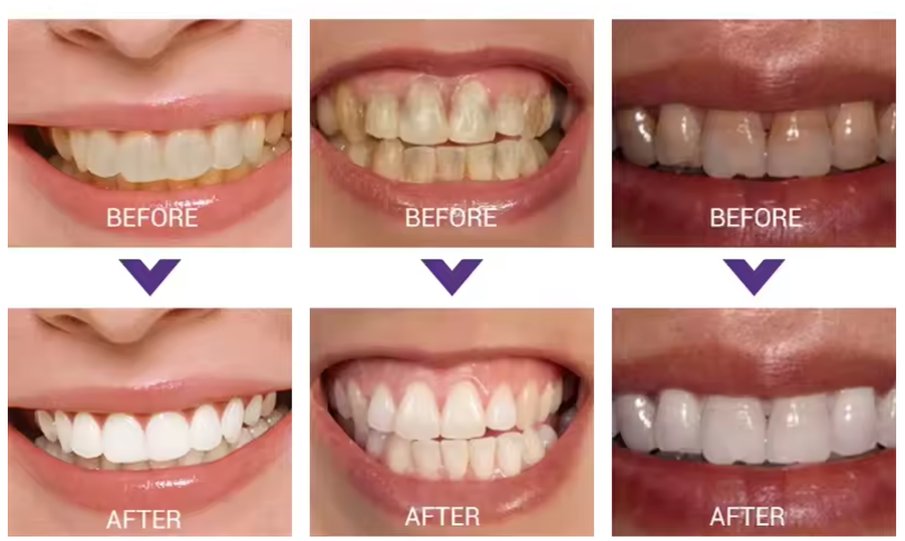 Wybielacz do Zębów z Pasta