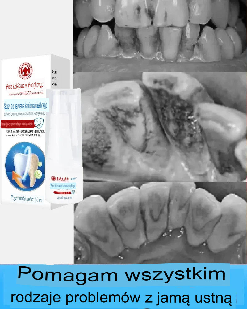 Spray do świeżego oddechu